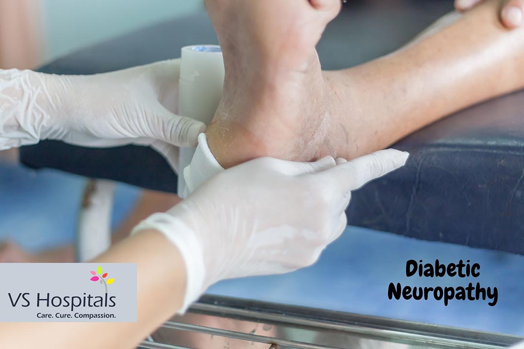 Whats is Diabetic Neuropathy? | Types, Causes & Symptoms | VS Hospitals
