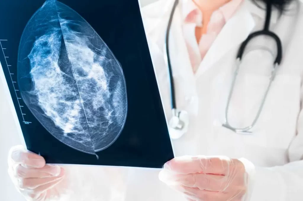 best Breast Cancer Treatment in Chennai - Breast Cancer DIAGNOSIS