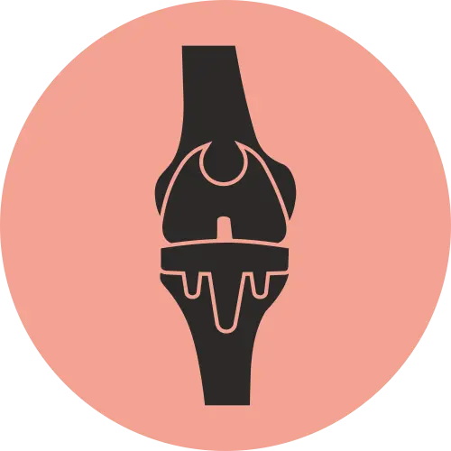 Smart Technique Knee Replacement - Icon