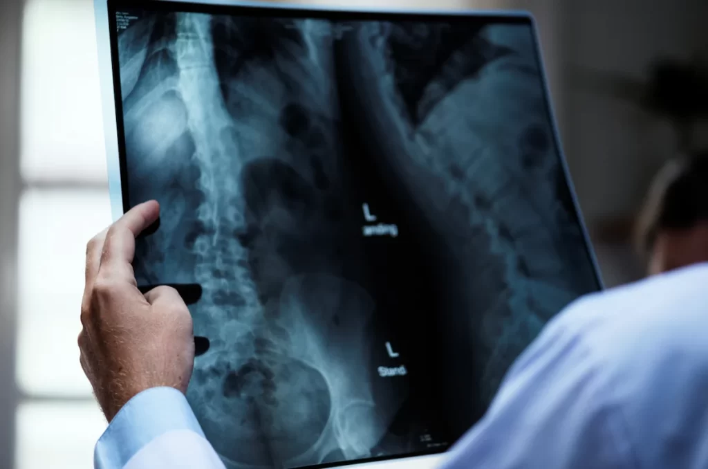 Spine Surgery in Chennai -Overview