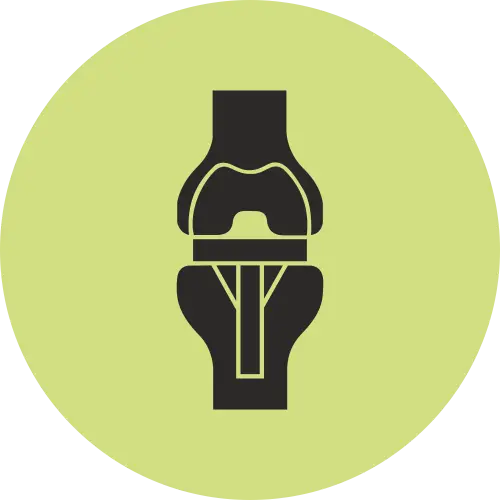 Total Knee Replacement - Icon