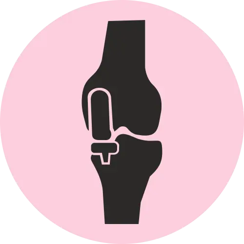 Unilateral Knee Replacement - Icon
