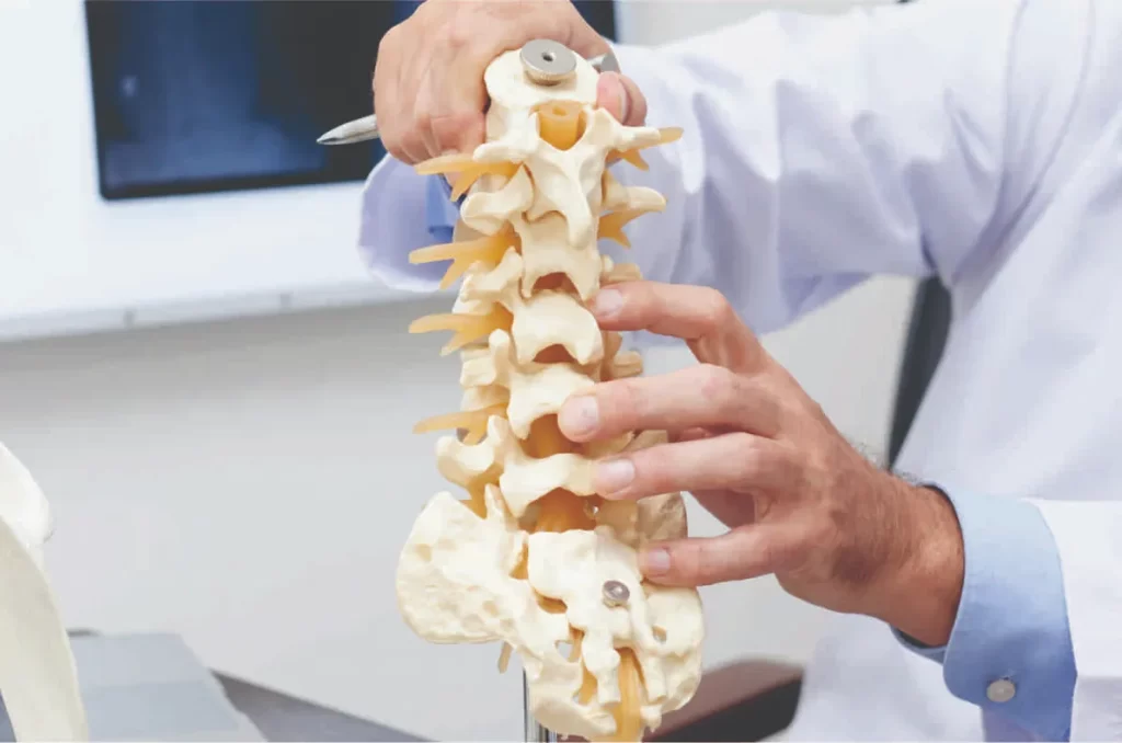 Spinal Fusion in Chennai