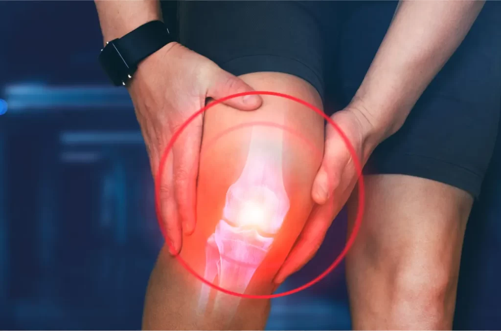 ACL Reconstruction treatment in chennai sign