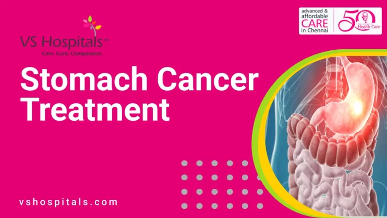 Stomach Cancer Treatment