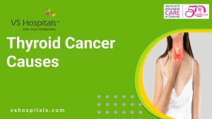 Thyroid Cancer Causes | VS Hospitals
