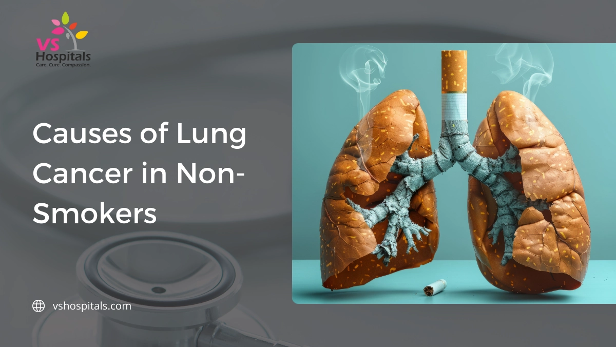 Causes of Lung Cancer in Non Smoker