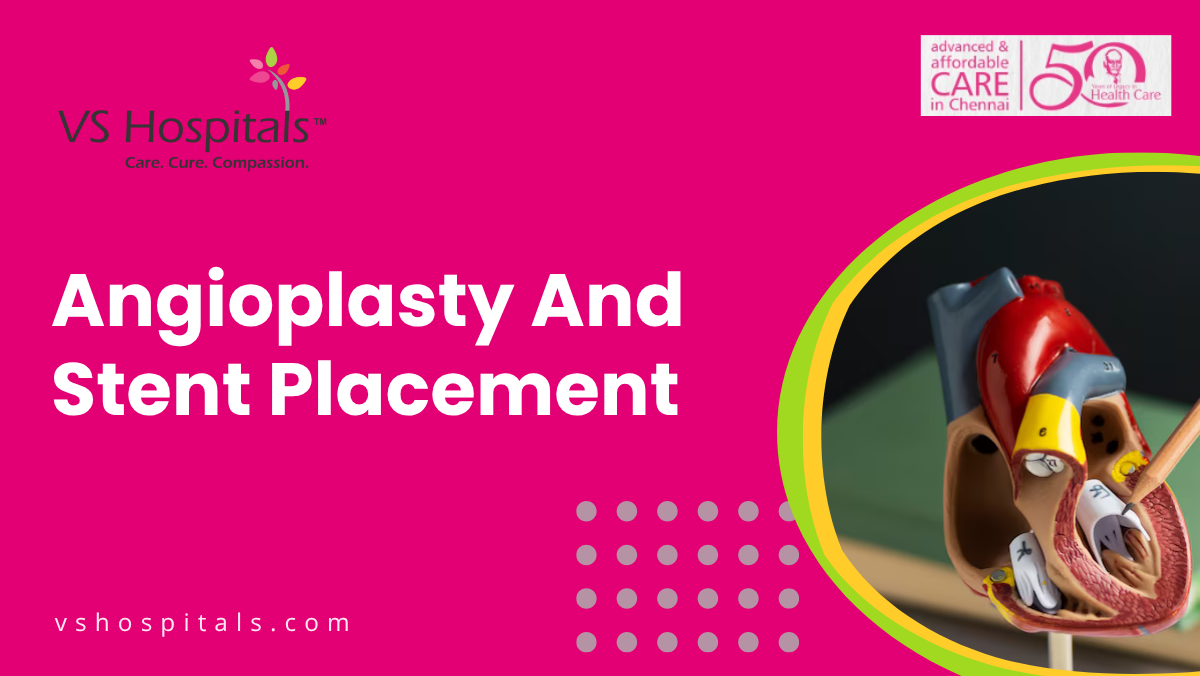 Angioplasty And Stent Placement