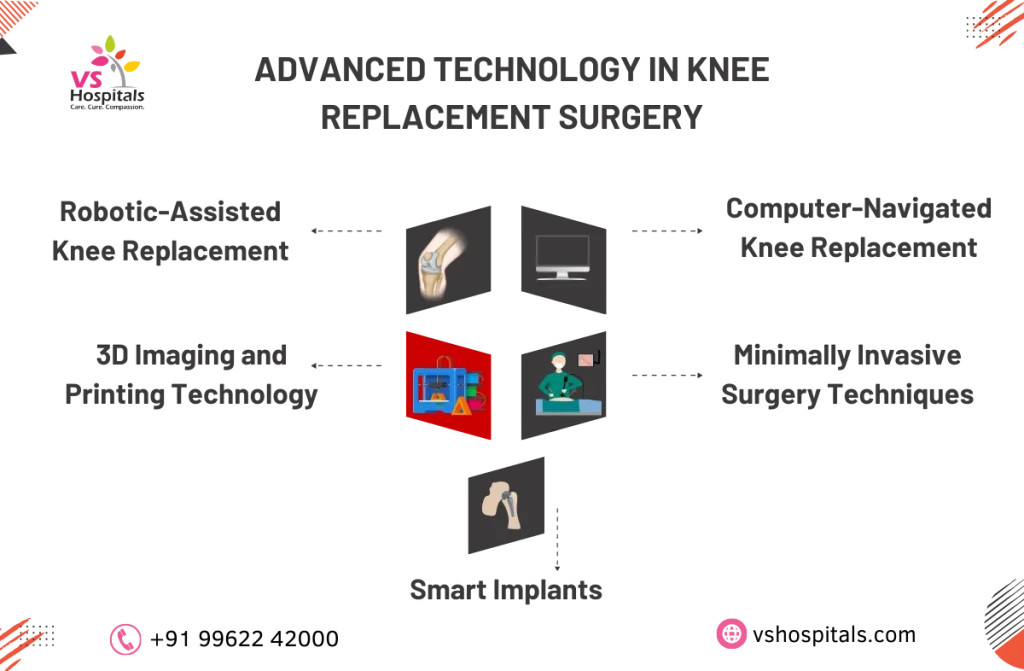 Best Knee Replacement Hospitals in Chennai