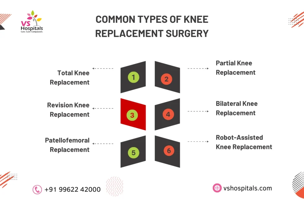 Types of Knee Replacement Surgery