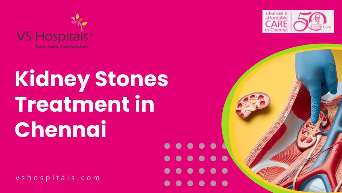 Kidney Stones Treatment In Chennai