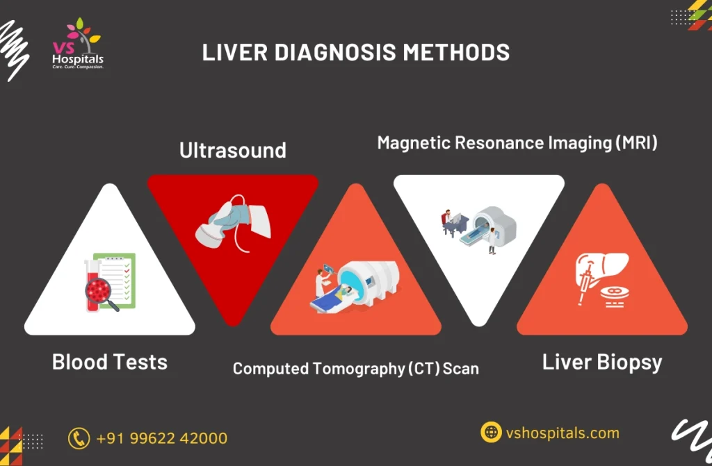 Liver Specialist In Chennai