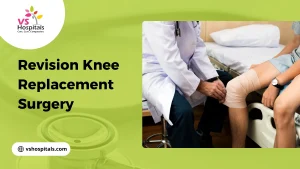 Revision Knee Replacement Surgery