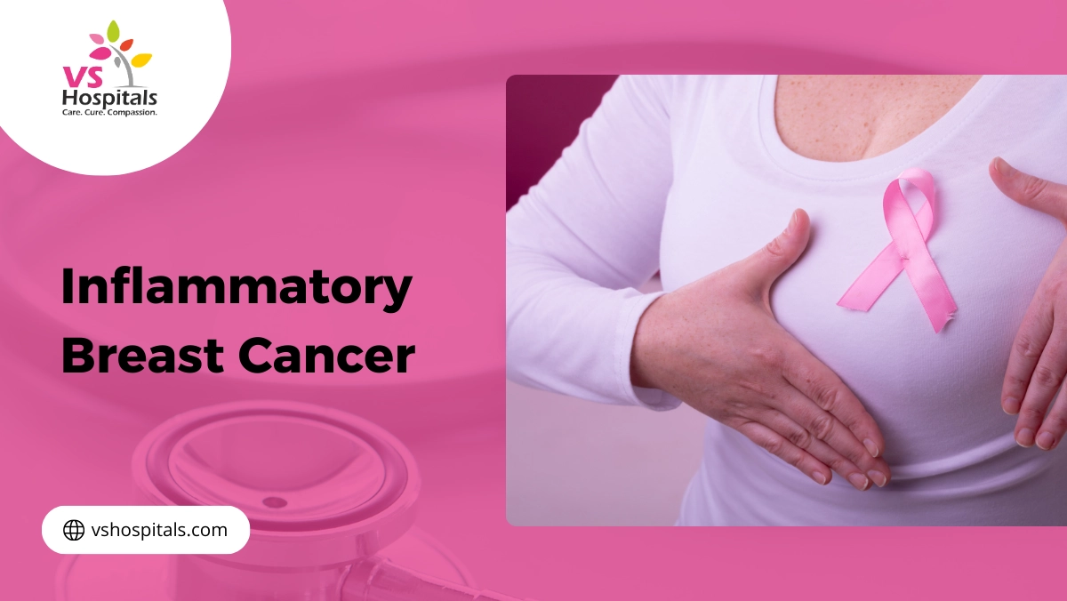 Inflammatory Breast Cancer