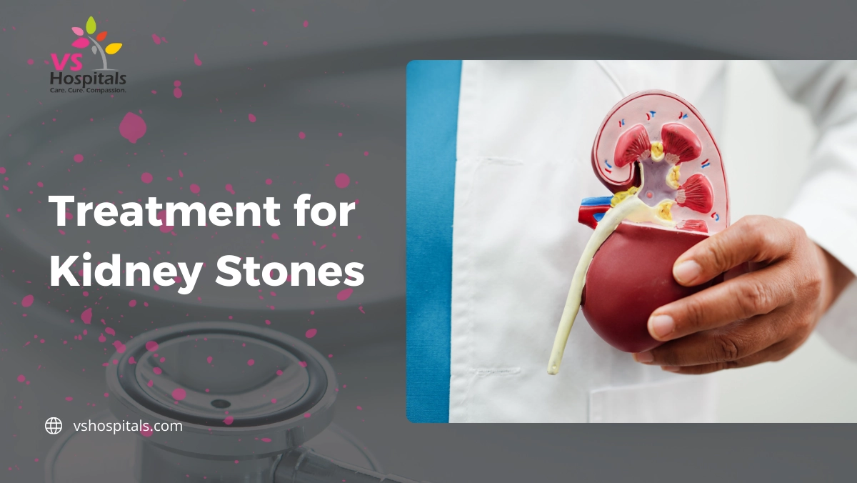 Treatment For Kidney Stones