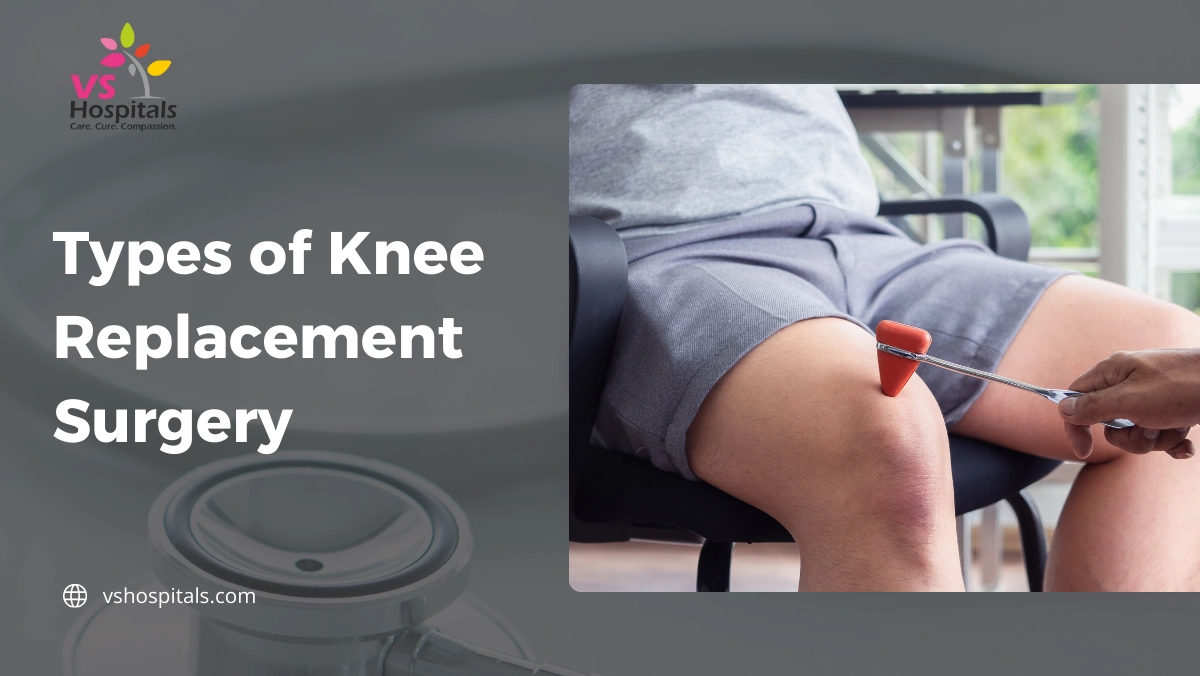 Types of Knee Replacement Surgery