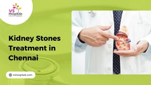 Kidney Stones Treatment In Chennai