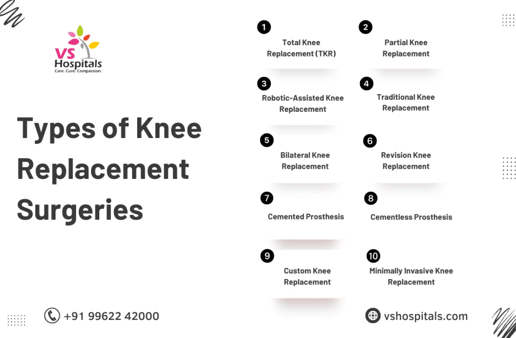 Knee Replacement Surgery Cost in Chennai